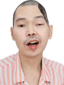 走失者照片 佛山市寻亲：中年男子被救助，自写名...