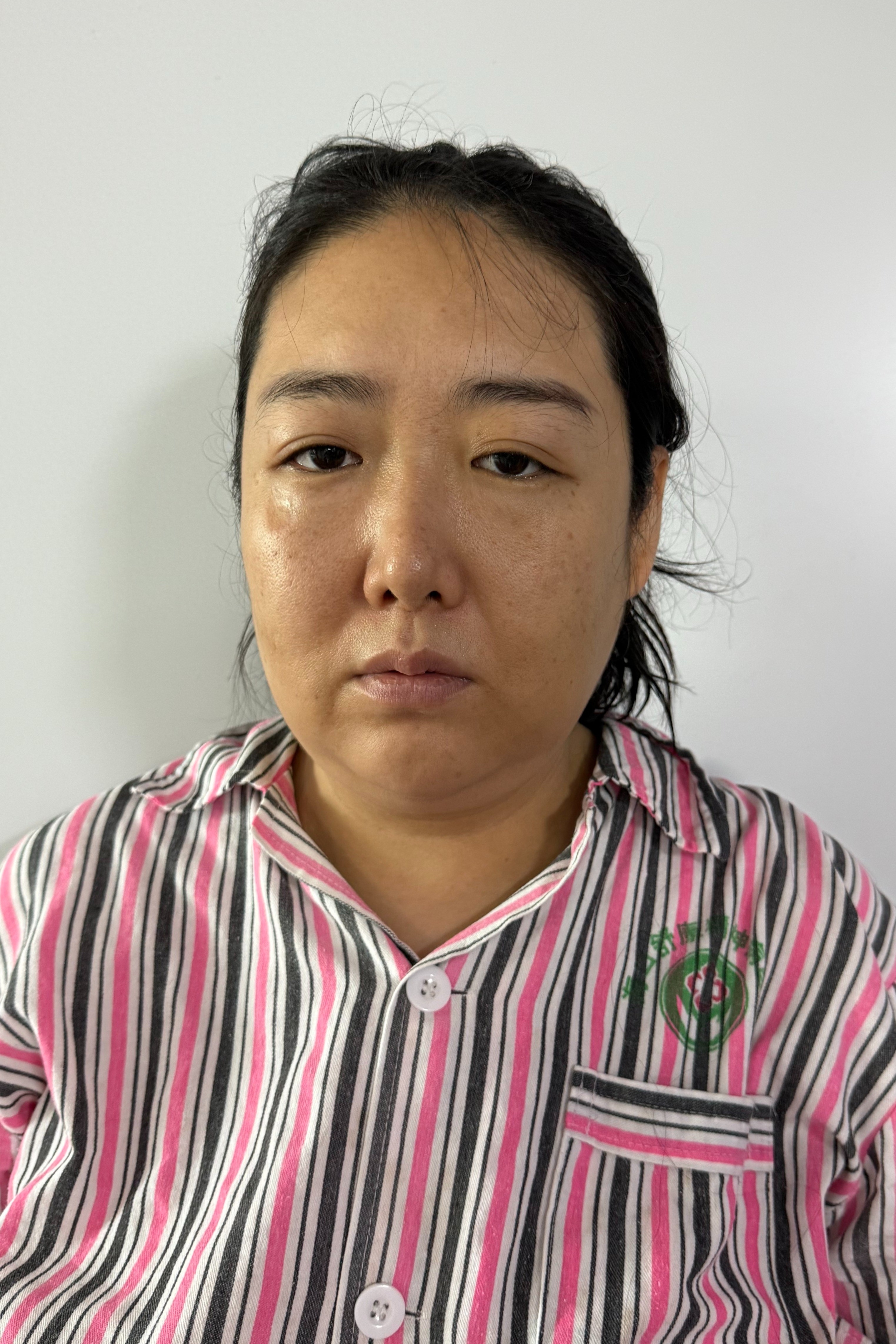 走失者照片 海口市寻亲：青年女子被救助，经查名...