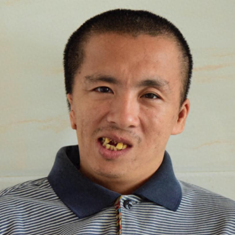 走失者照片 厦门市寻亲：中年男子被救助，疑似姓...