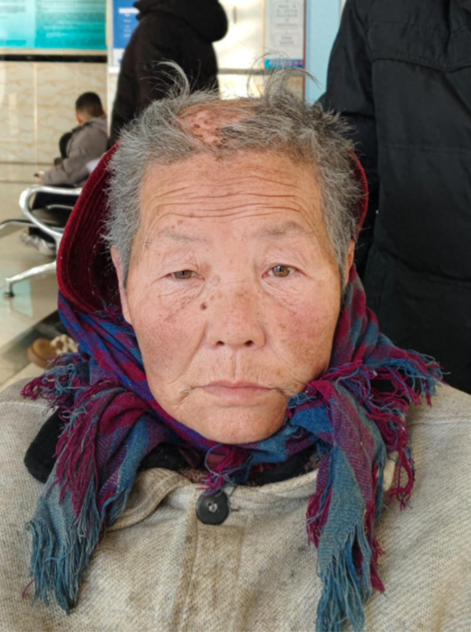 走失者照片 唐山市遵化市寻亲：六旬老太被救助，...
