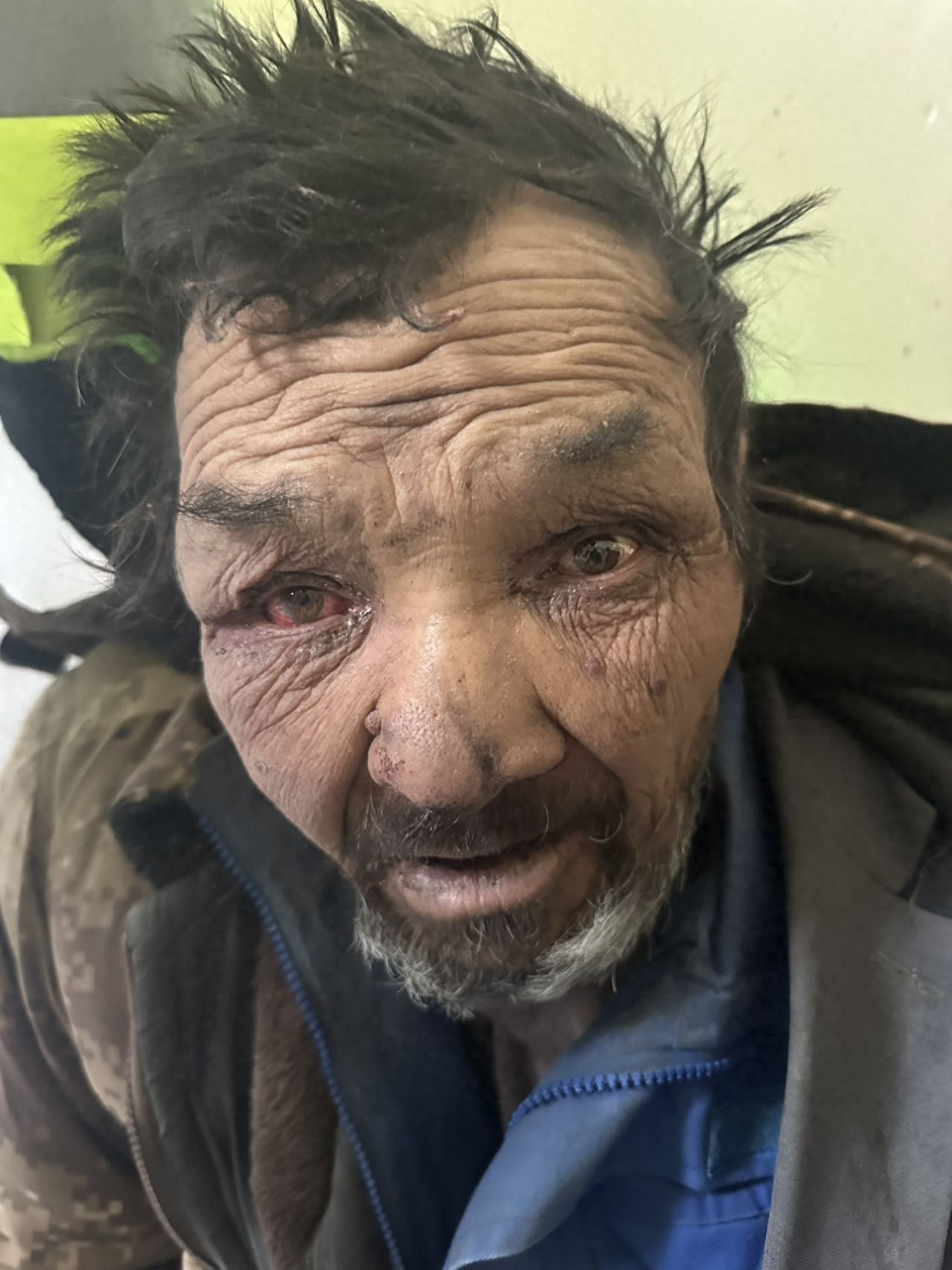 走失者照片 阿克苏地区阿克苏市寻亲：七旬老人被...