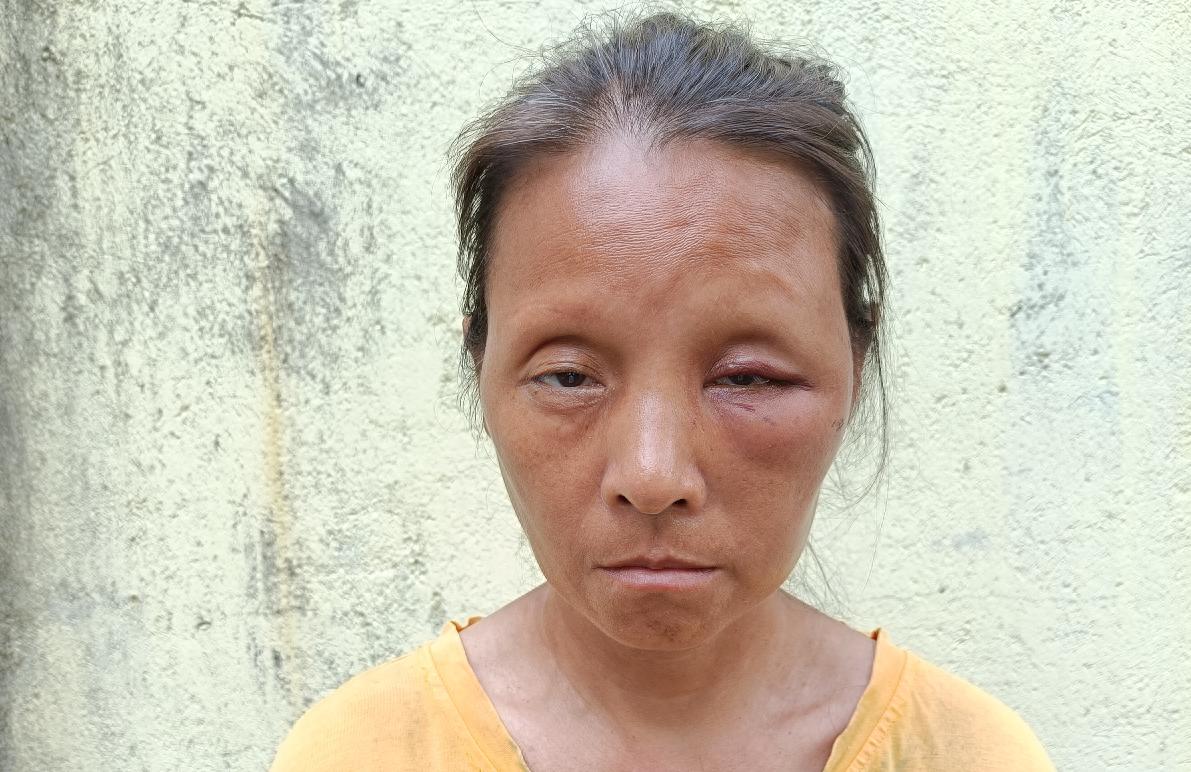 走失者照片 阳江市寻亲：五旬女子被救助，穿黄色...