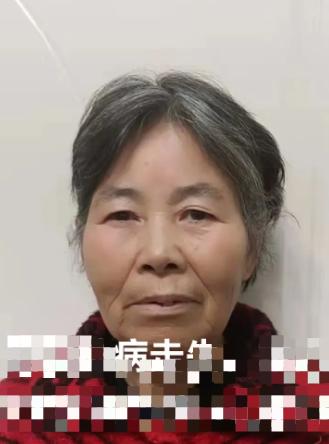 走失者照片 平顶山市寻人：七旬老太走失，精神异...
