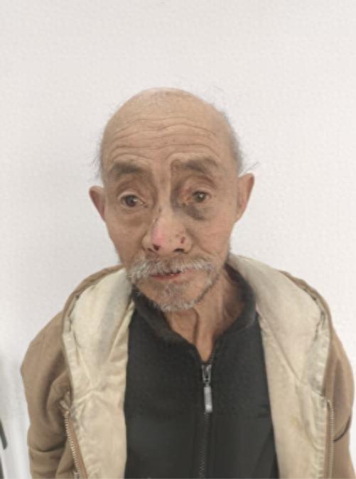 走失者照片 北京市寻亲：七旬老人被救助，疑似安...