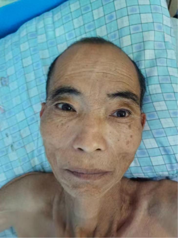 走失者照片 海南省乐东县寻亲：六旬老人被救助，...