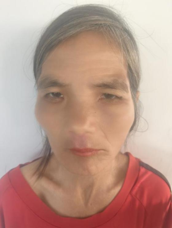 走失者照片 云浮市寻亲：中年女子被救助，穿短袖...
