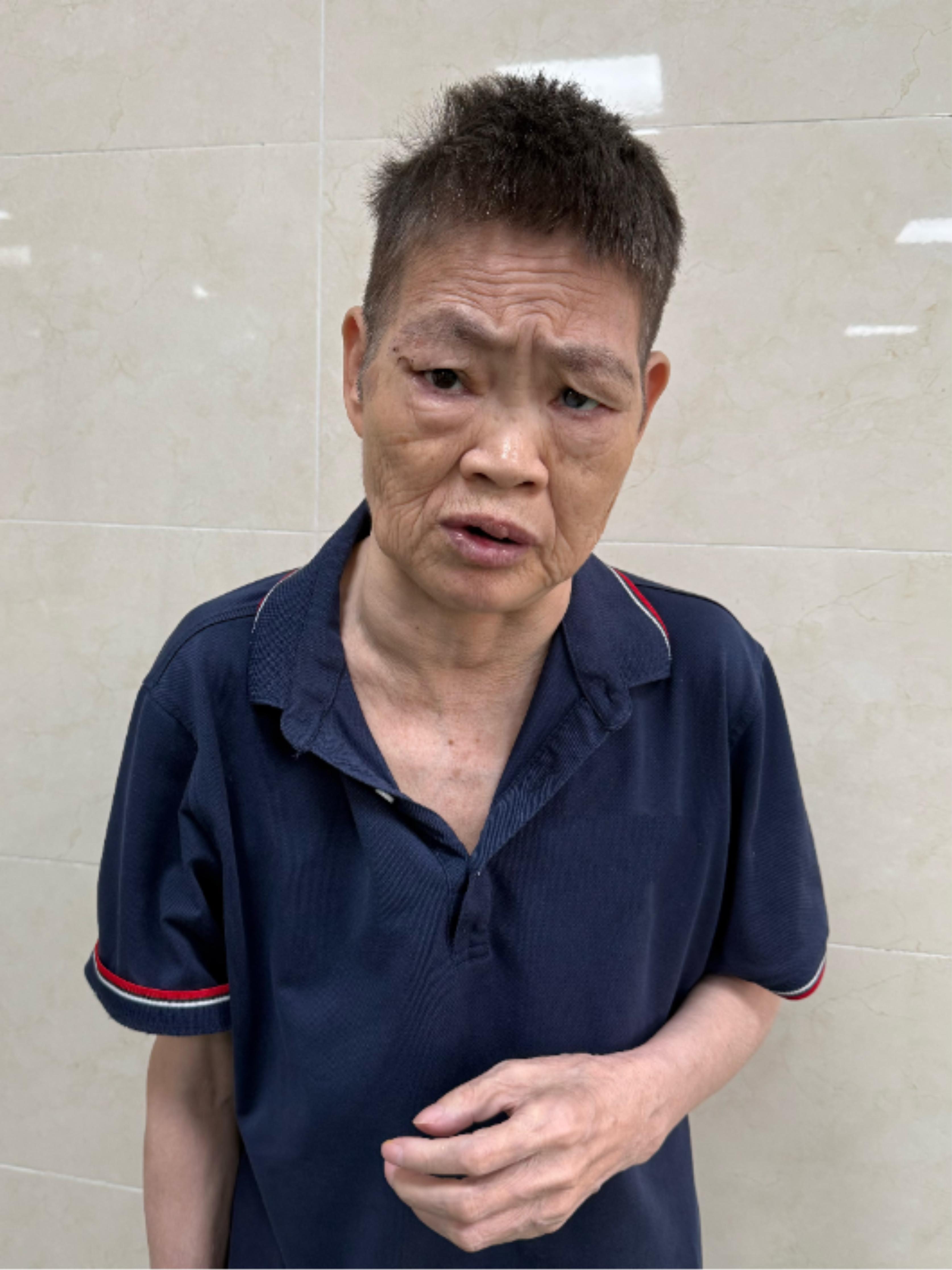 走失者照片 广州市寻亲：七旬老太被救助，疑似湖...