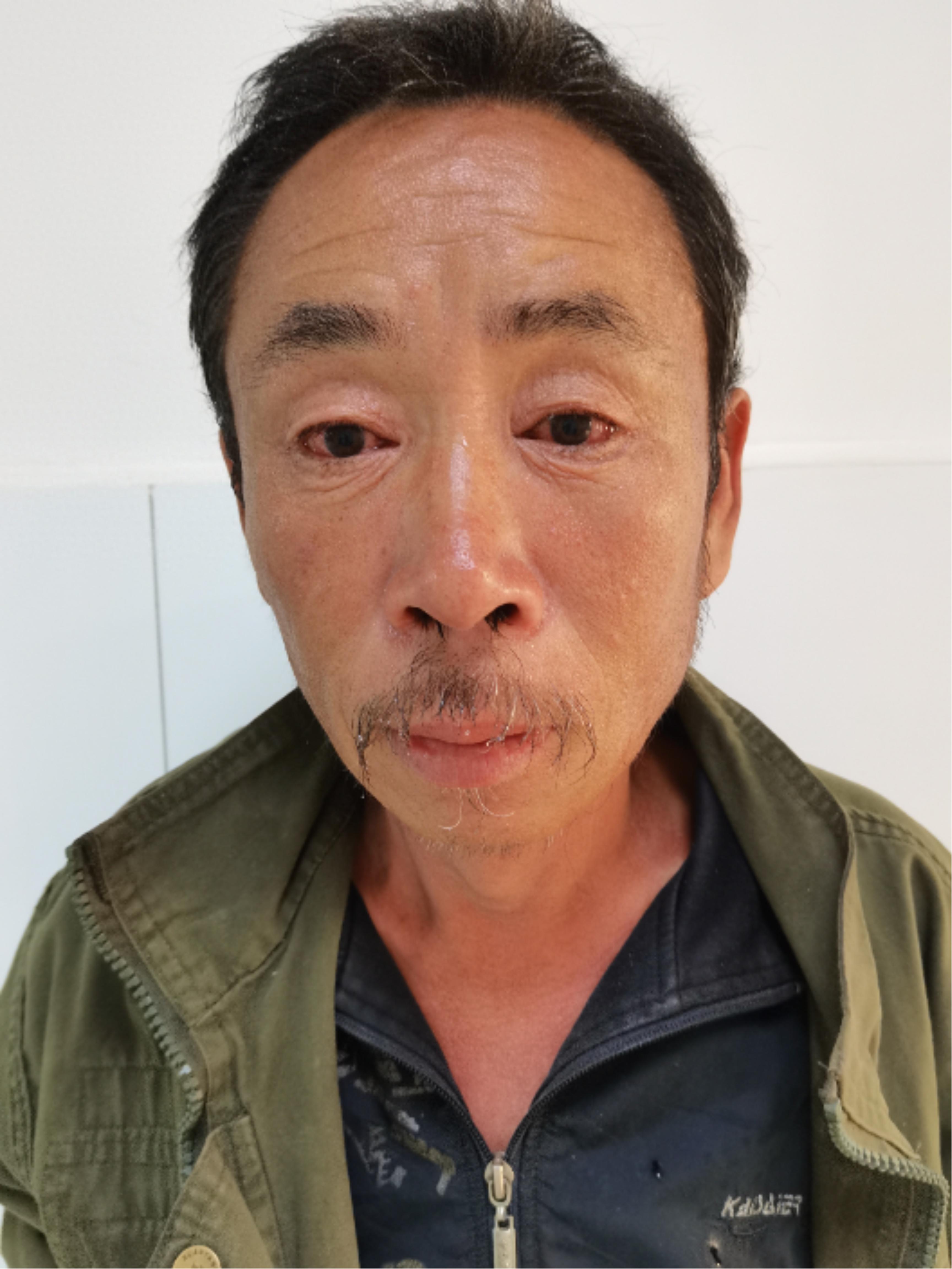 走失者照片 石家庄市寻亲：六旬老人被救助，穿军...