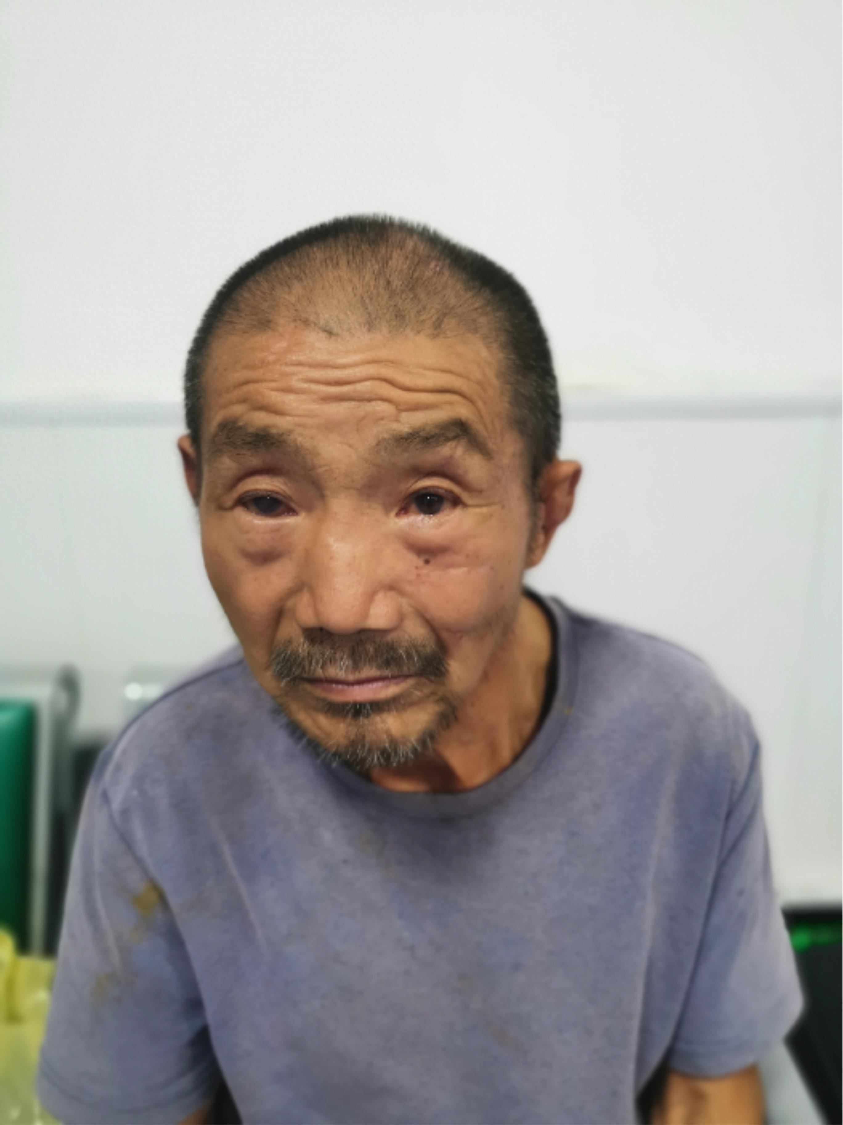 走失者照片 襄阳市寻亲：六旬老人被救助，穿灰色...