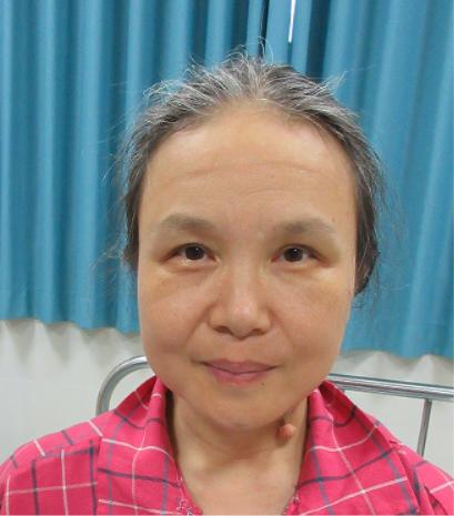 走失者照片 广州市寻亲：中年女子被救助，自述叫...