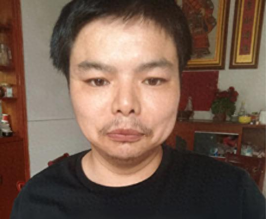 走失者照片 宜春市丰城市寻人：青年男子走失，患...