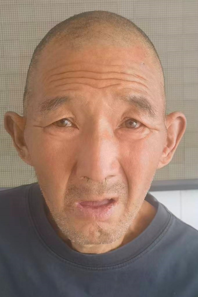 走失者照片 全国救助站