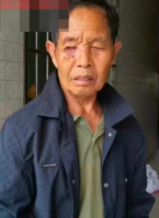 走失者照片 怀化市寻人：七旬老人走失，穿深色外...