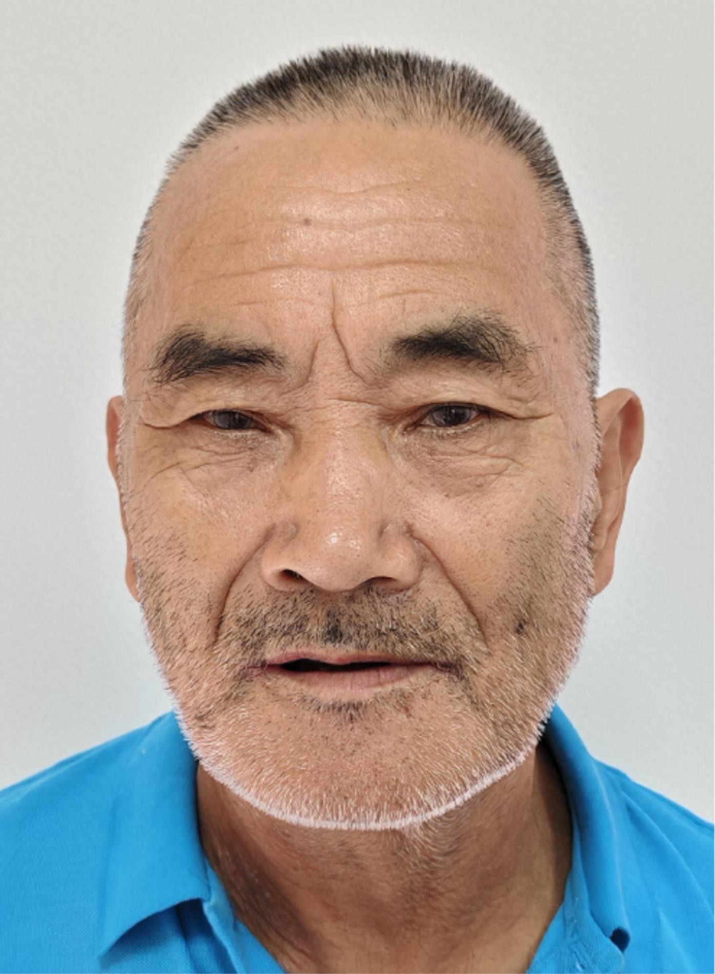 走失者照片 广州市寻亲：六旬老人被救助，自写名...