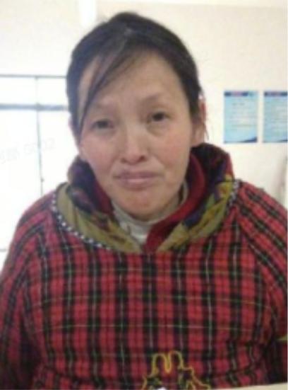 走失者照片 池州市寻亲：五旬女子被救助，自述叫...