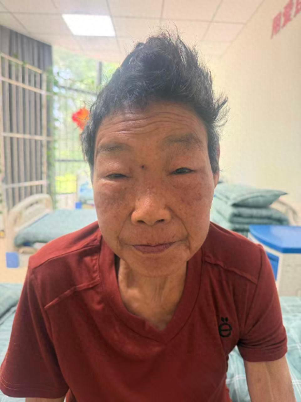 走失者照片 平顶山市寻亲：六旬老人被救助，自述...