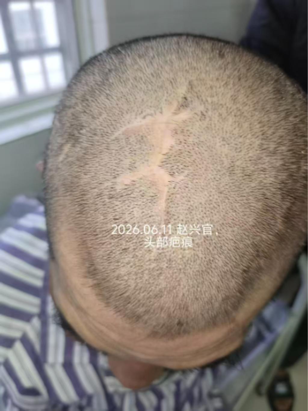 走失者照片 毕节市寻亲：五旬男子被救助，自述叫...