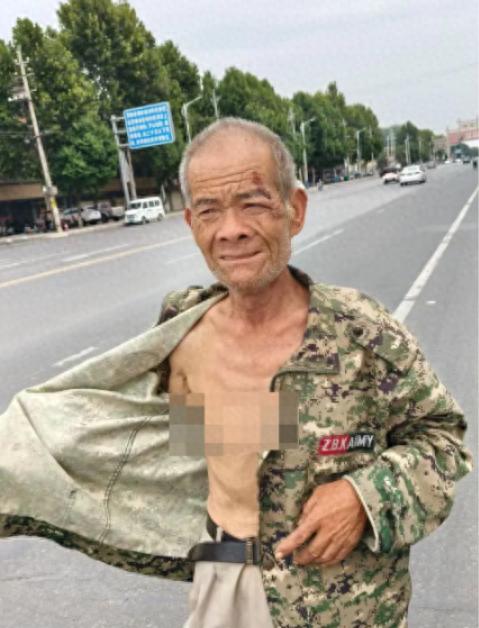 走失者照片 漯河市寻人：六旬老人走失，穿军绿色...