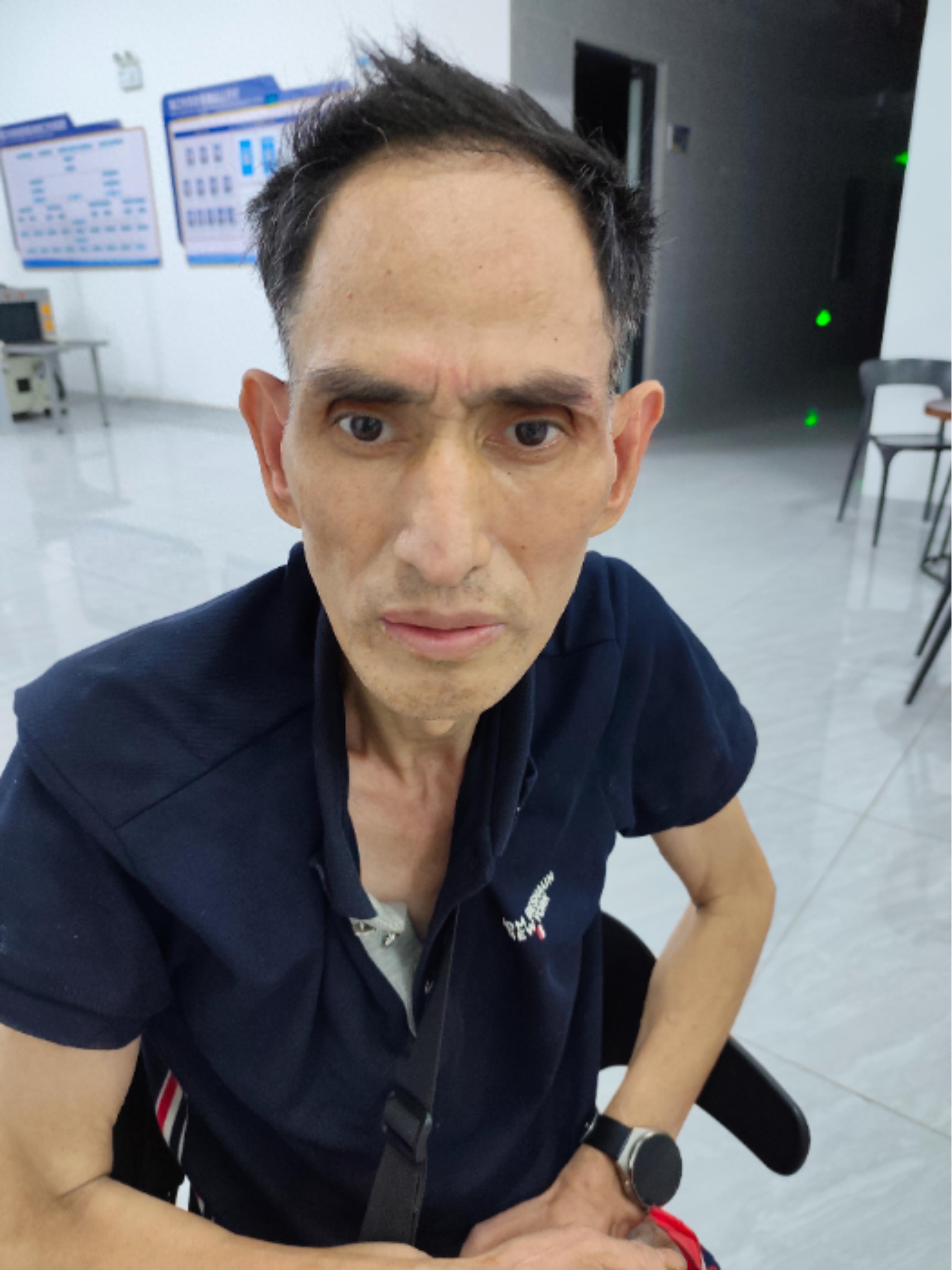 走失者照片 海口寻亲：五旬男子被救助，自述叫曹...