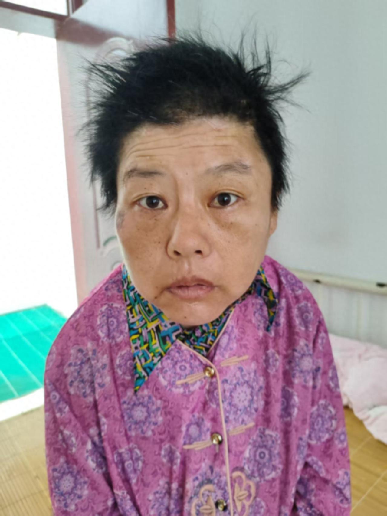 走失者照片 南阳市寻亲：五旬女子被救助，自述叫...