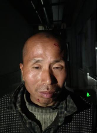 走失者照片 亳州市寻亲：中年男子被救助，穿黑底...