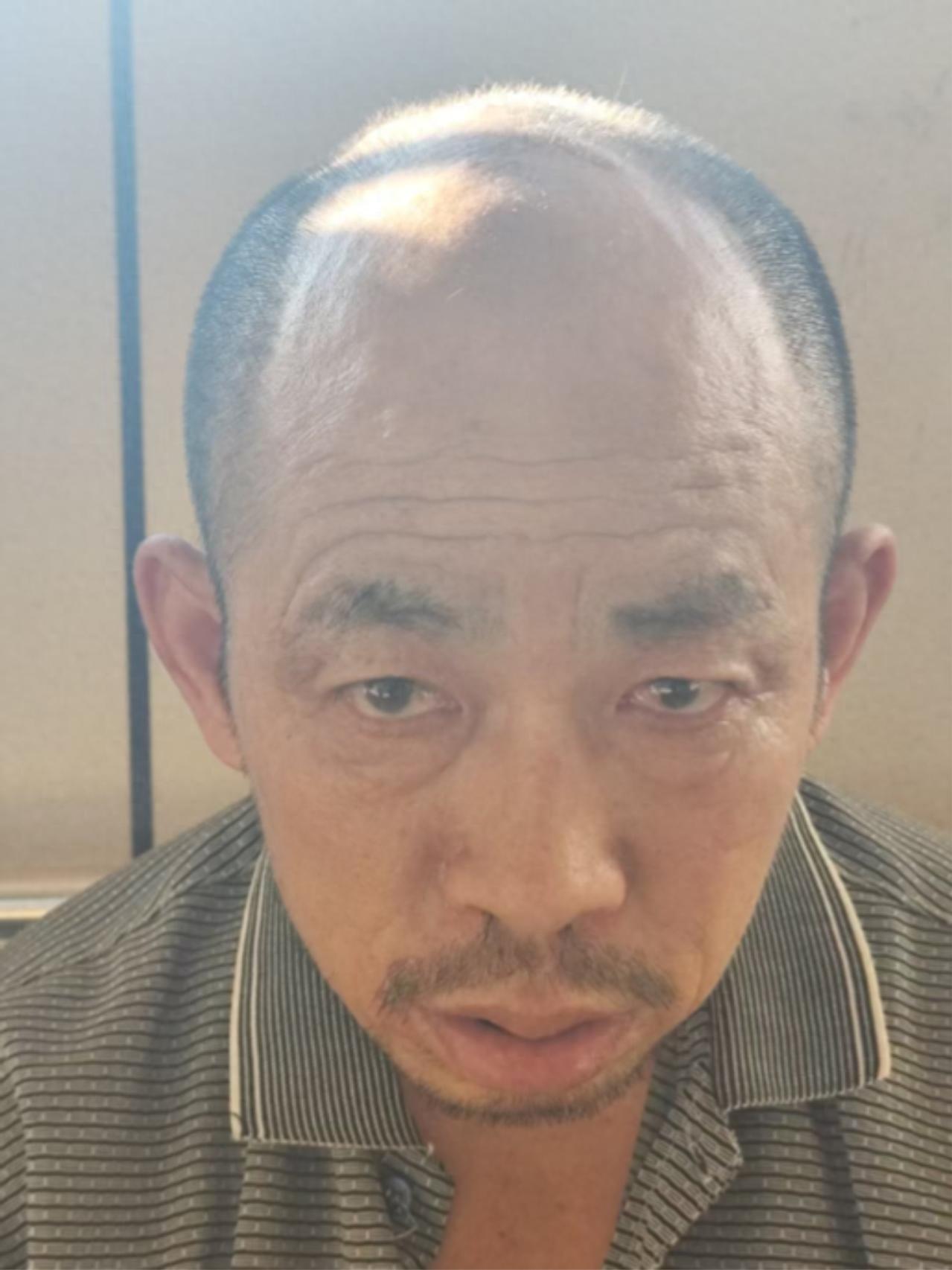 走失者照片 漳州市寻亲：五旬男子被救助，穿灰色...