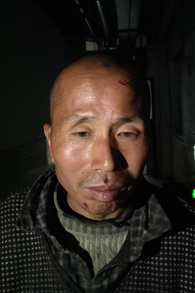 走失者照片 全国救助站