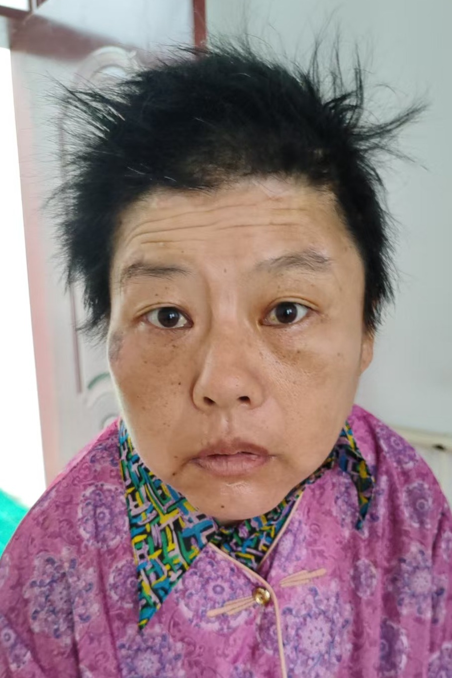 走失者照片 全国救助站