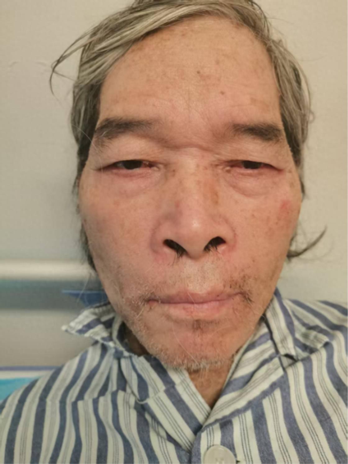走失者照片 贺州市寻亲：六旬老人被救助，高1米...