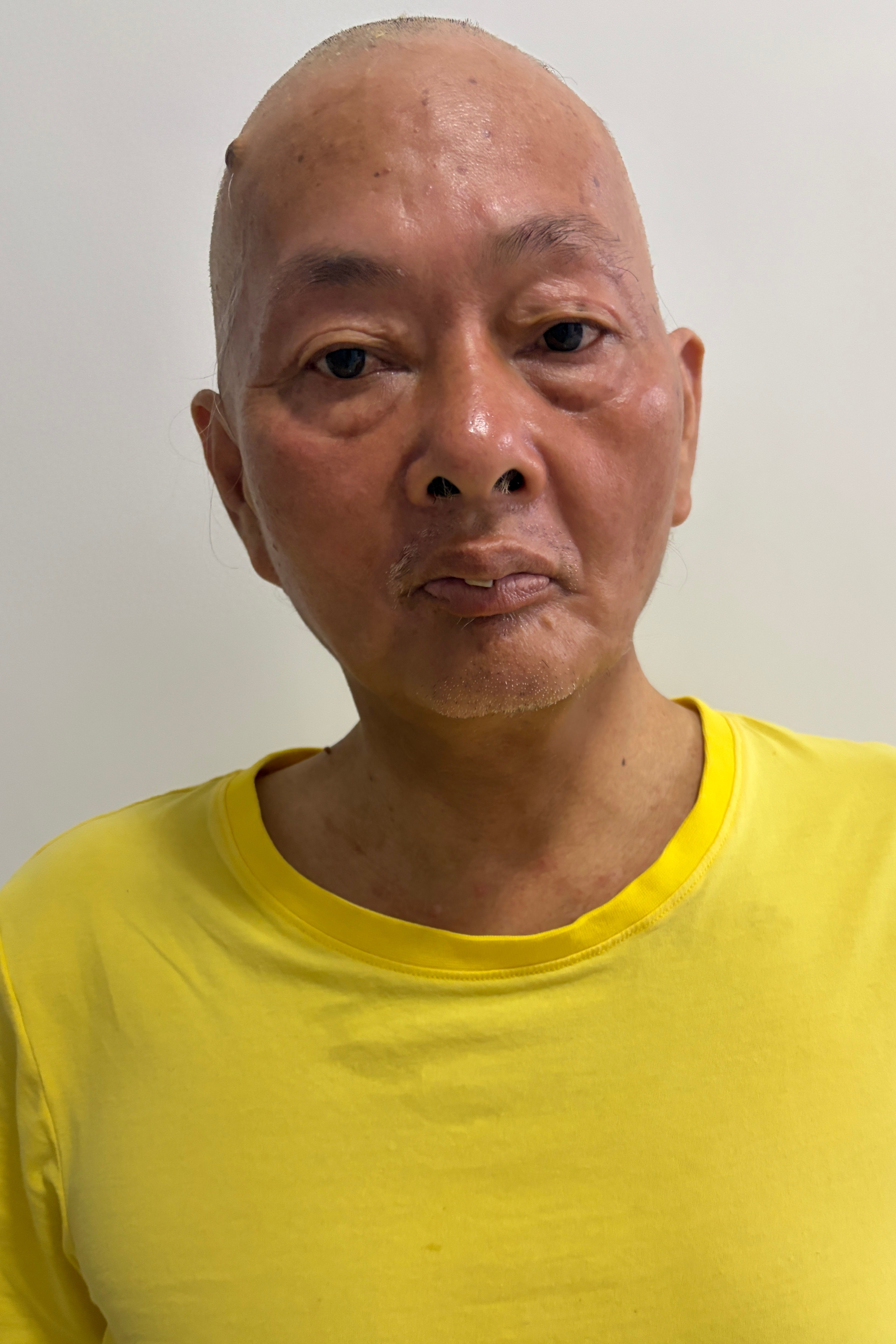 走失者照片 梧州岑溪寻亲：五旬男子被救助，穿橙...