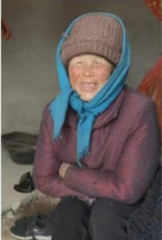 走失者照片 临沂市寻人：七旬老太走失，穿花上衣...