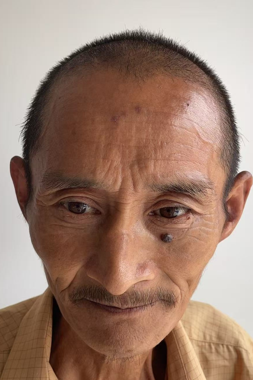 走失者照片 全国救助站