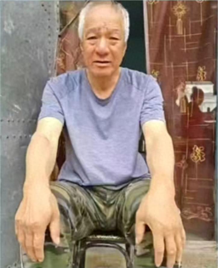 走失者照片 吉林寻人：六旬老人走失，患小脑萎缩...