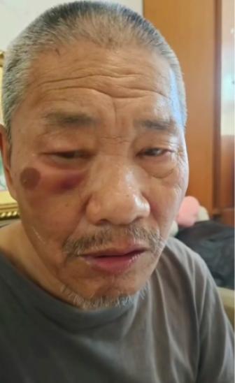 走失者照片 西安市寻人：六旬老人走失，患脑梗后...