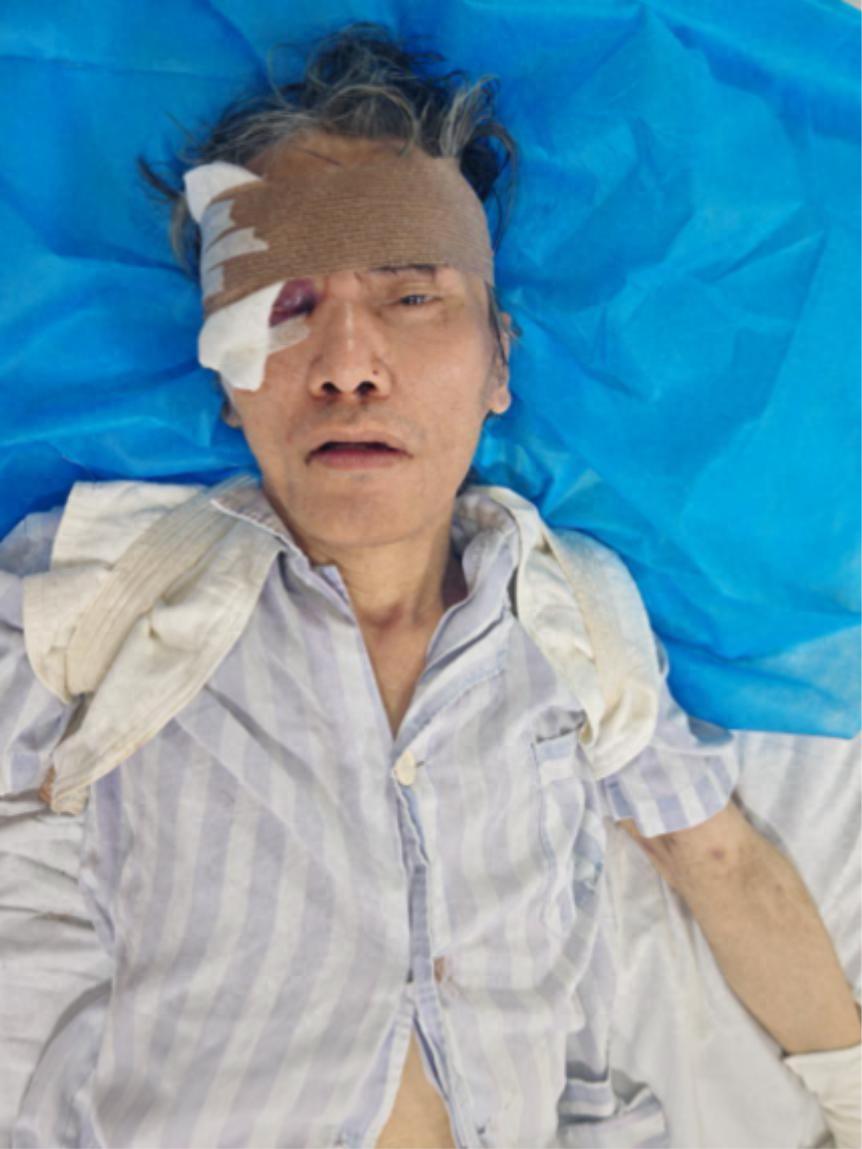 走失者照片 河池市寻亲：五旬男子被救助，穿黑色...