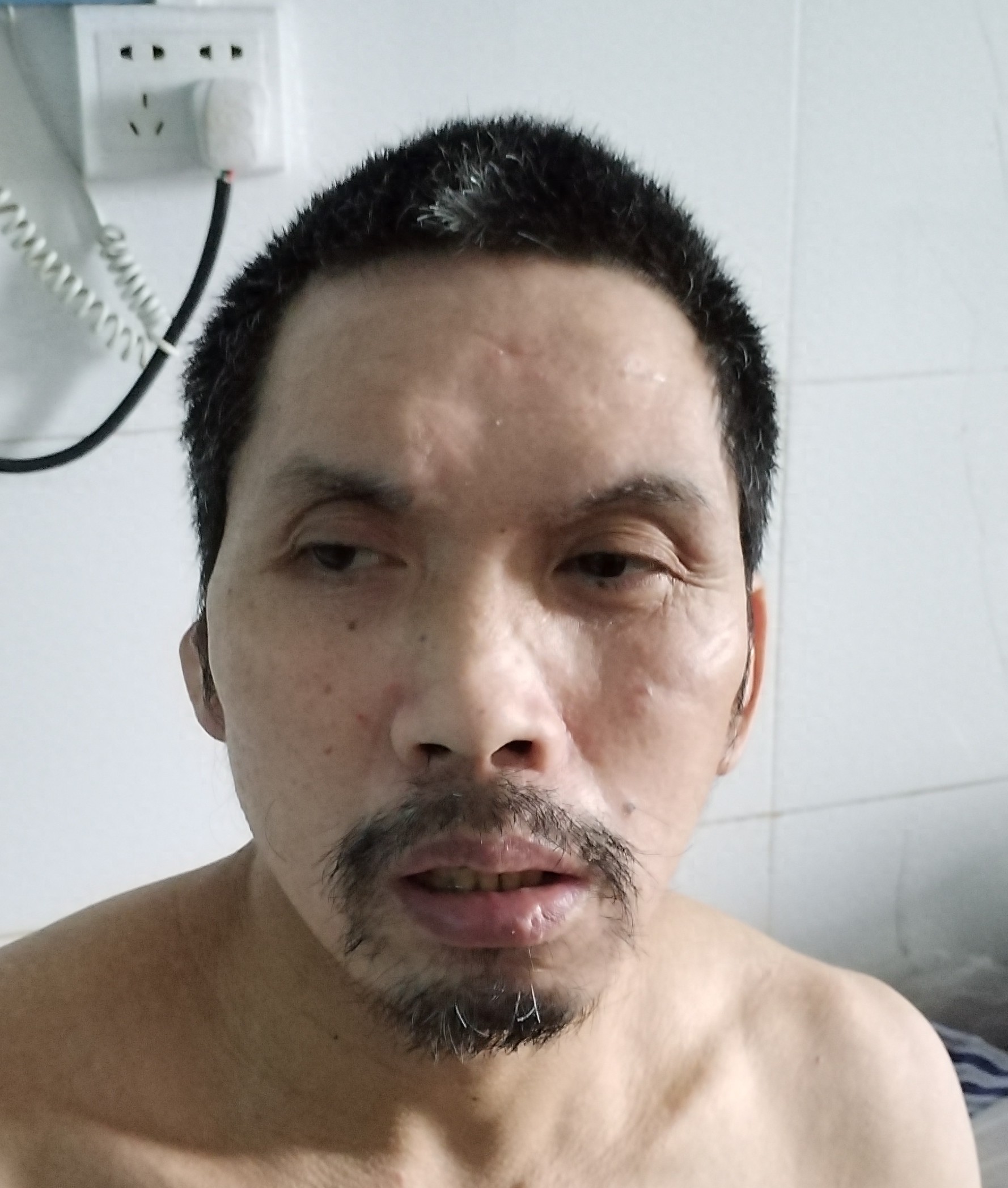 走失者照片 湛江市吴川市寻亲：五旬男子被救助，...