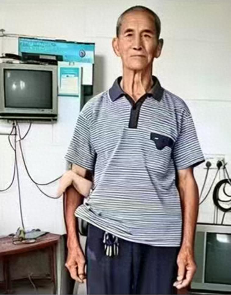 走失者照片 河池市寻人：八旬老人走失，穿蓝色外...