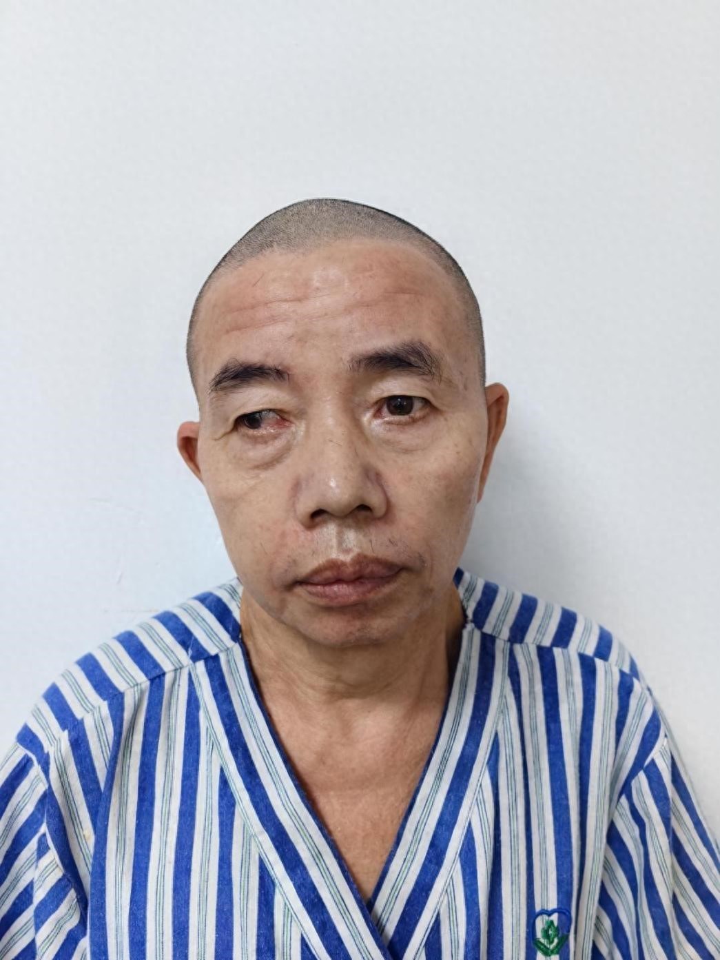 走失者照片 珠海市寻亲：中年男子被救助，疑患精...