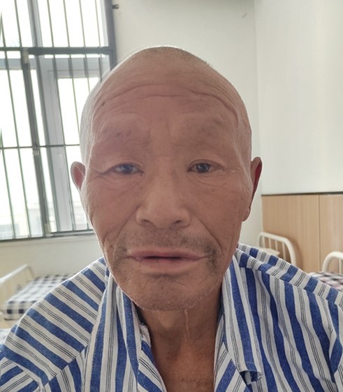 走失者照片 泰安市寻亲：六旬老人被救助，自述叫...