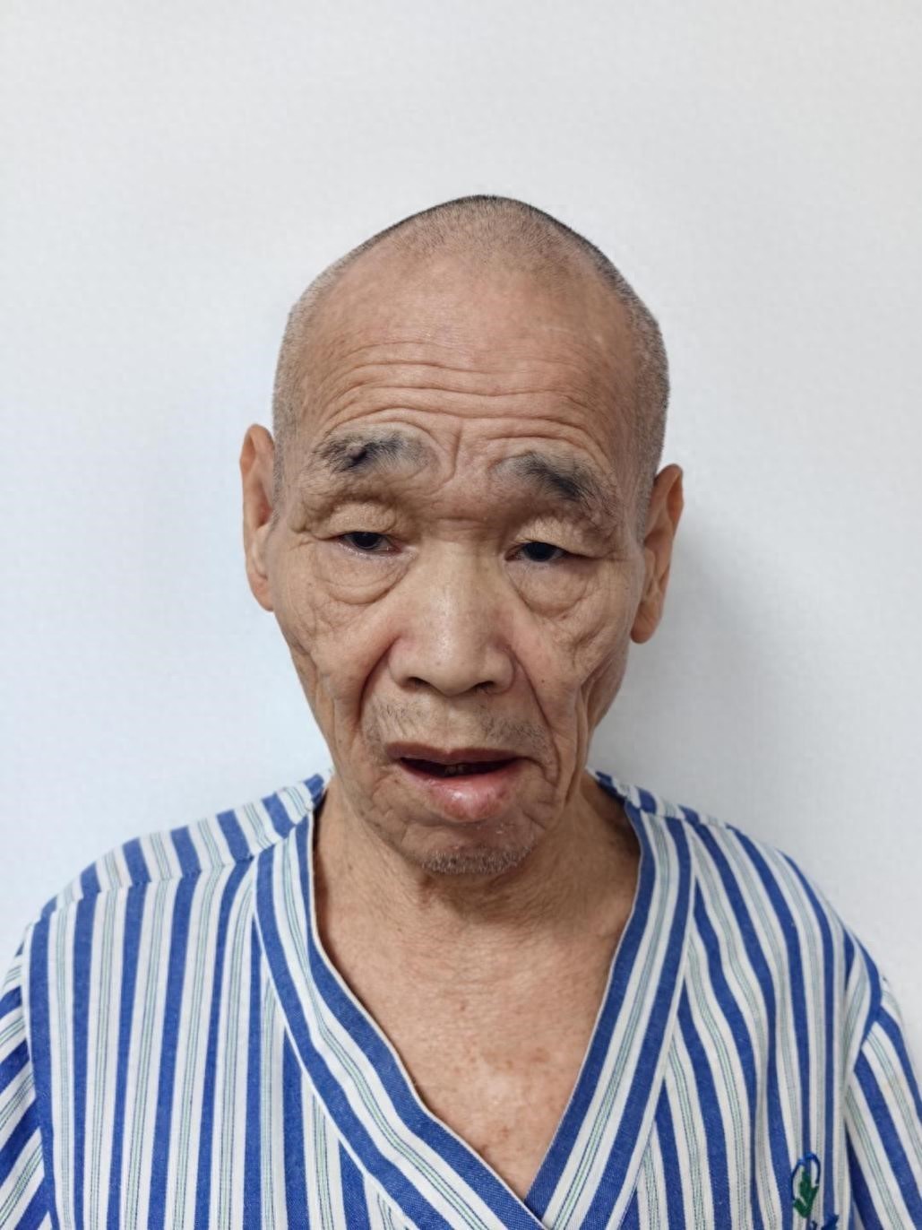 走失者照片 珠海市寻亲：七旬老人被救助，疑患精...
