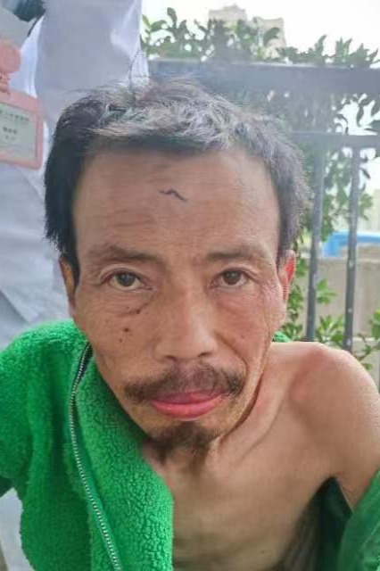 走失者照片 成都市寻亲：五旬男子被救助，穿绿色...