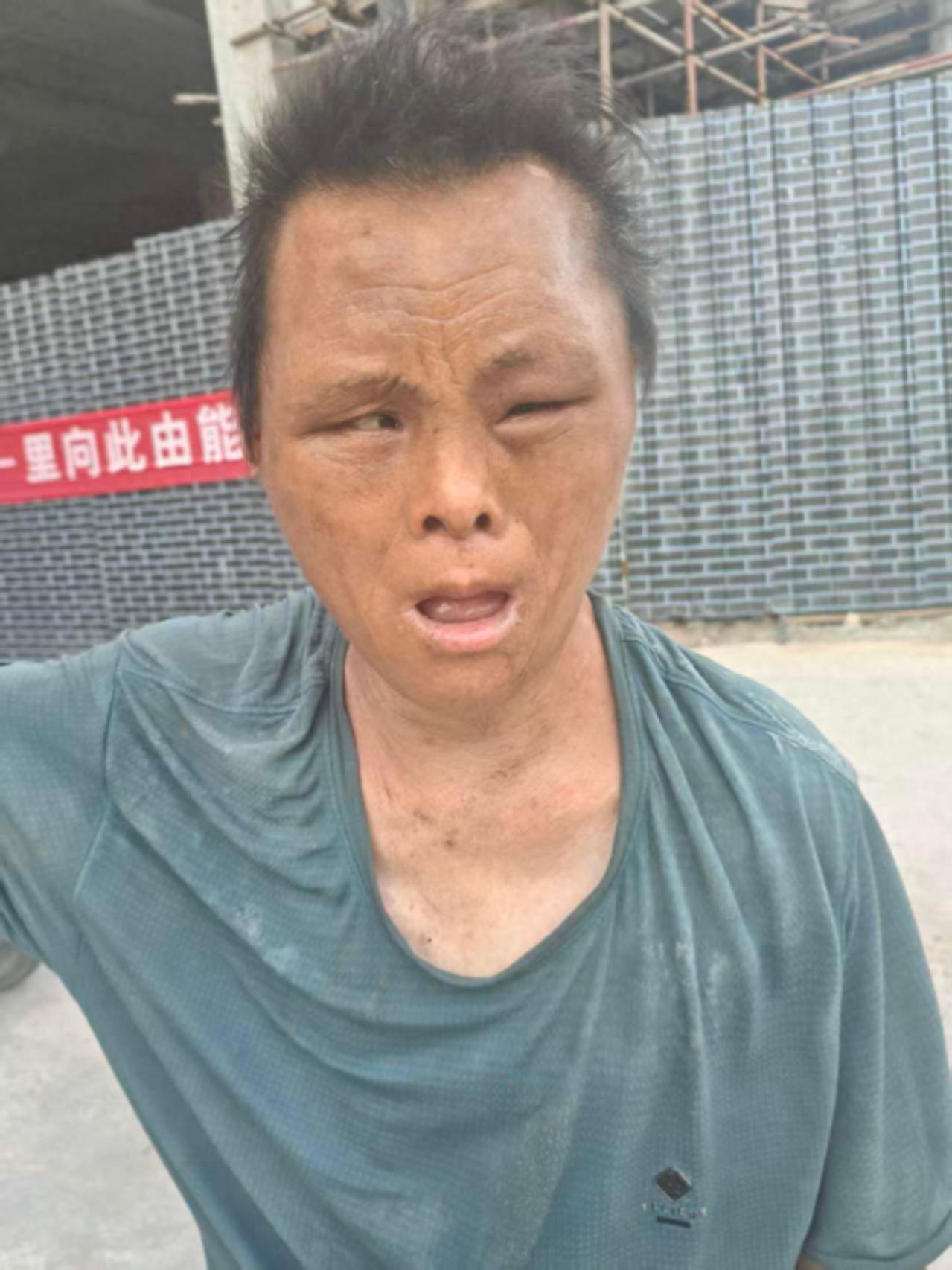 走失者照片 周口市寻亲：中年男子被救助，穿灰蓝...