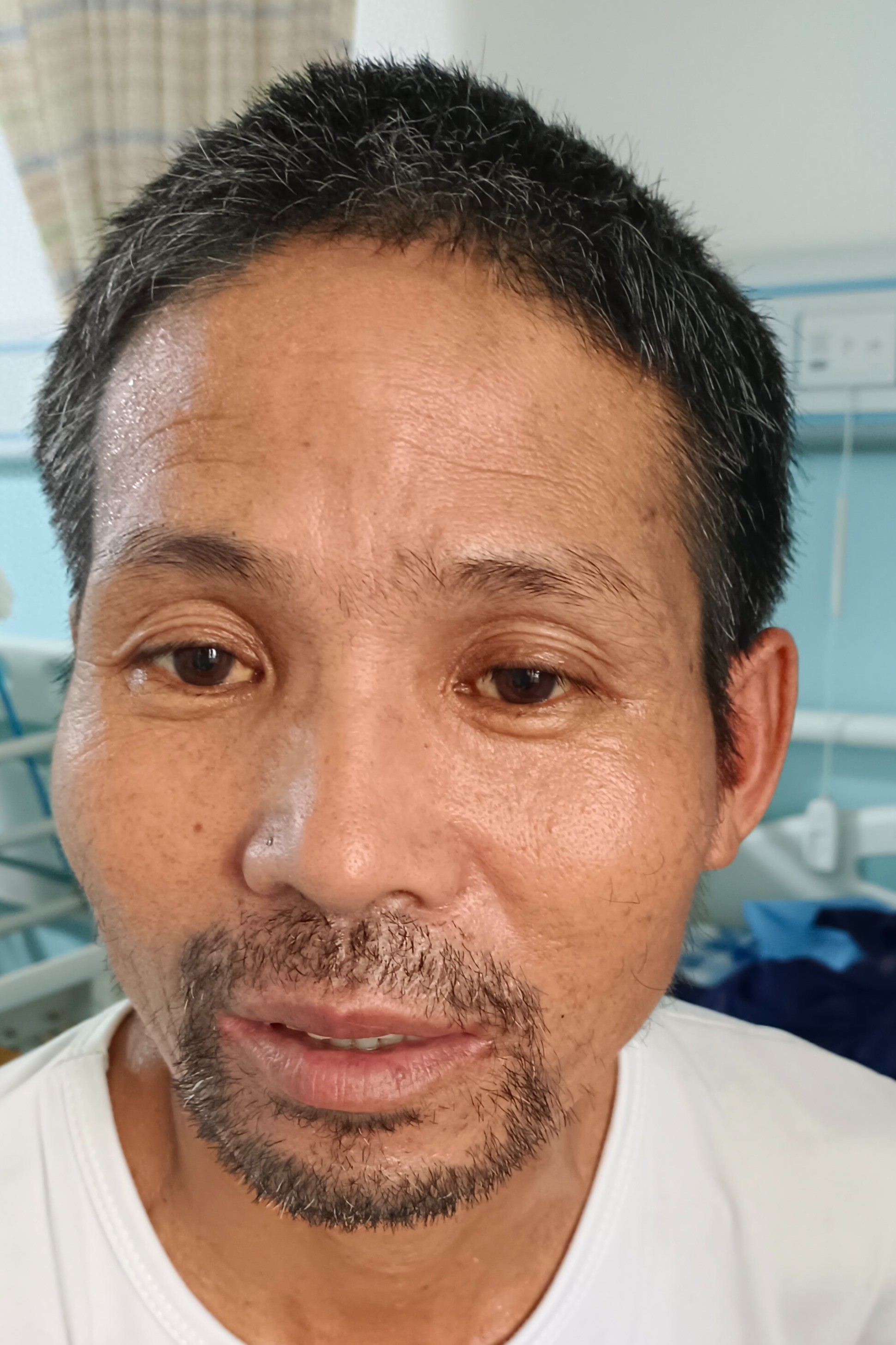 走失者照片 贵港市寻亲：中年男子被救助，高1米...