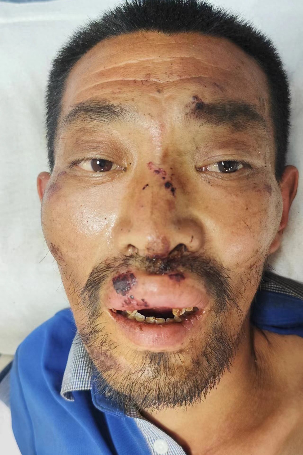 走失者照片 青岛市莱西市寻亲：六旬老人被救助，...