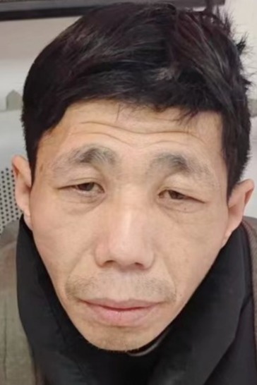 走失者照片 保定市寻亲：青年男子被救助，自述叫...