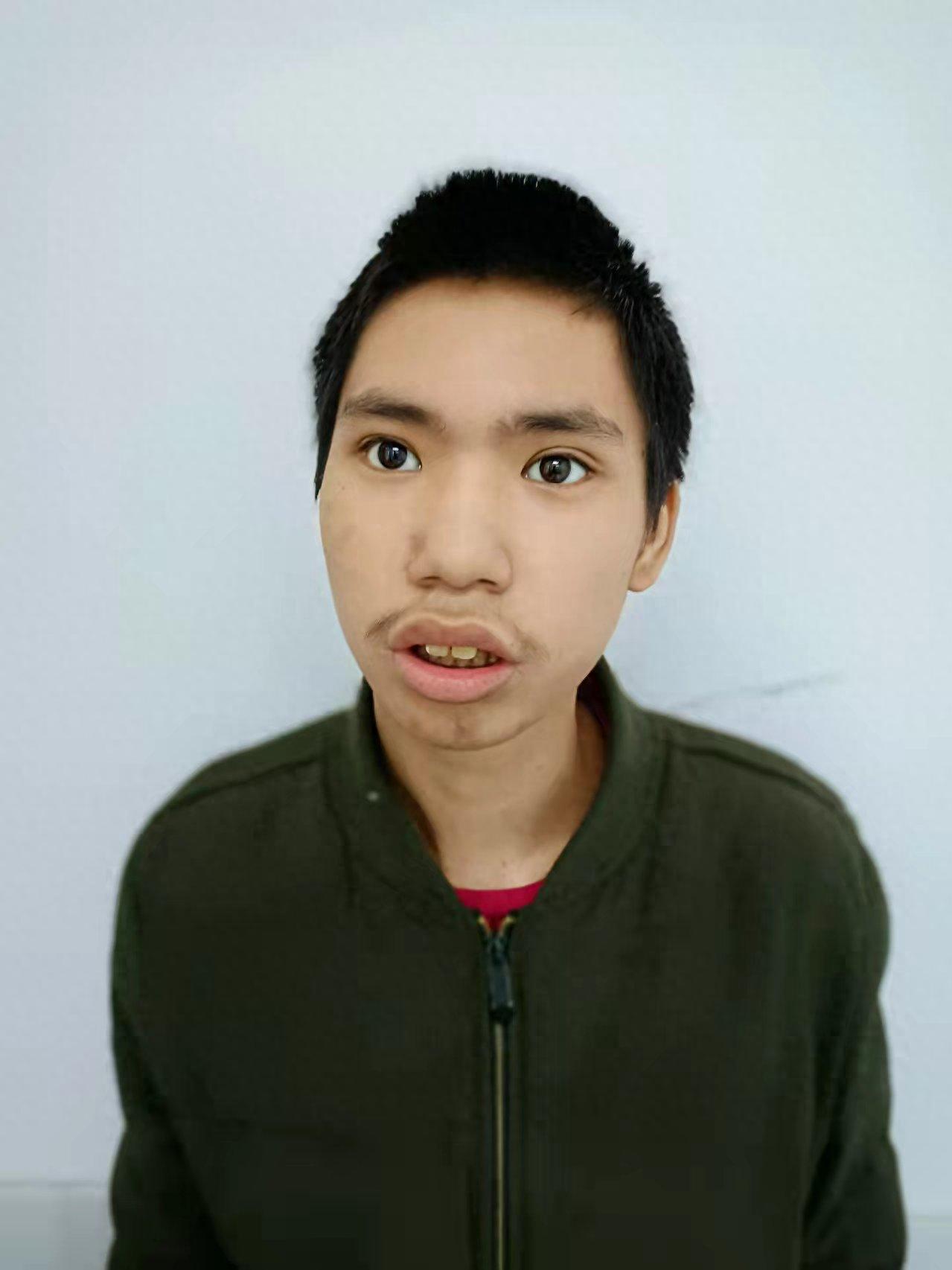 走失者照片 东莞市寻亲：青年男子被救助，疑似姓...