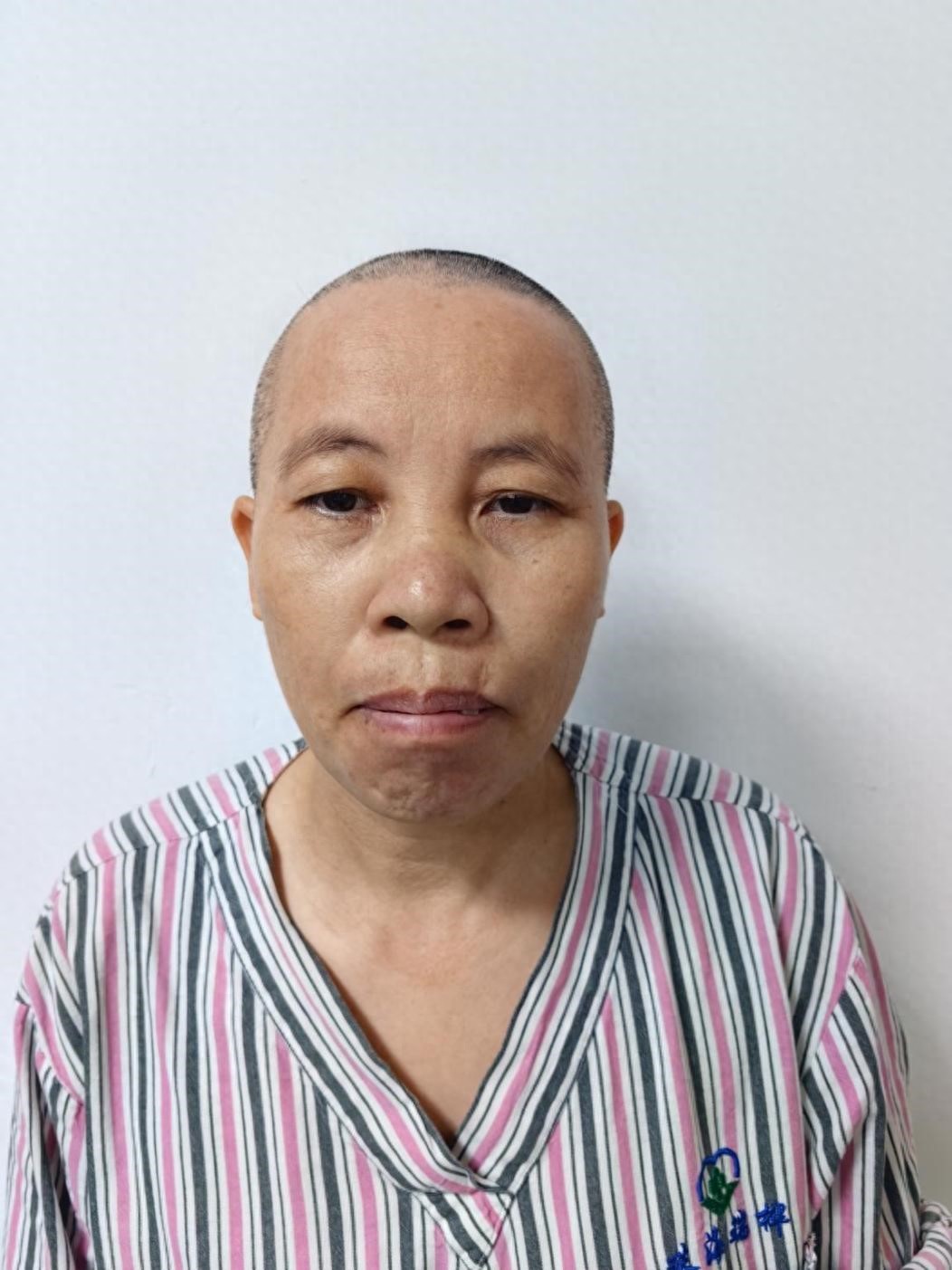 走失者照片 珠海市寻亲：五旬女子被救助，疑患精...