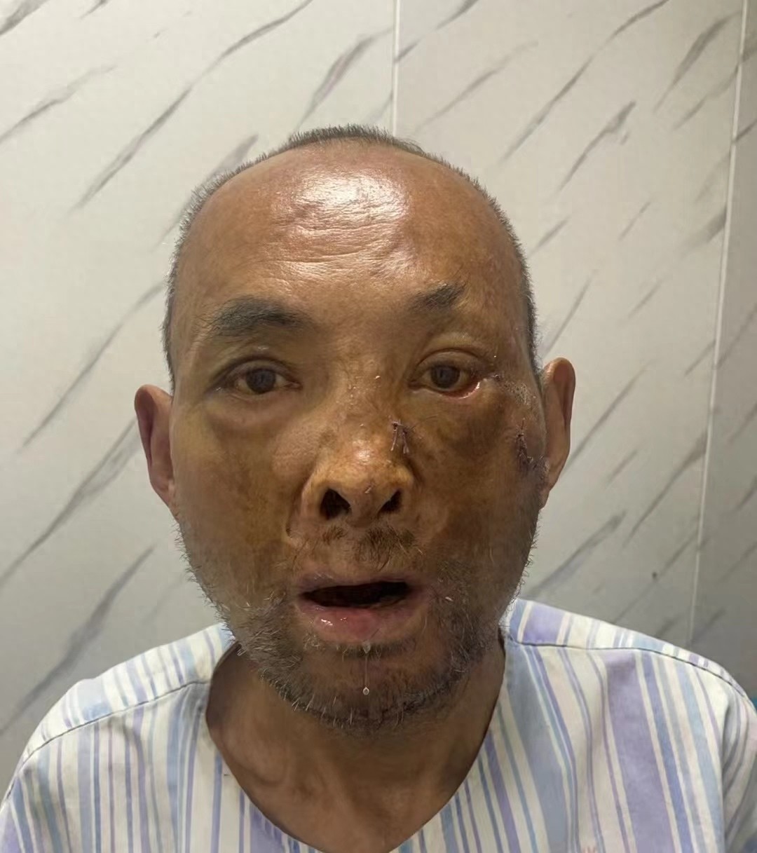 走失者照片 西安市寻亲：五旬男子被救助，脸部受...