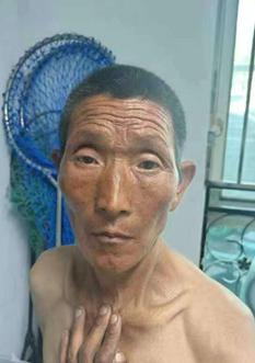 走失者照片 北京市寻亲:五旬男子被救助,高1米...