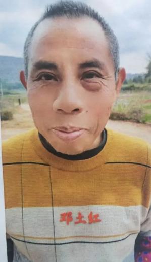走失者照片 永州市寻人：六旬老人走失，患抑郁症...
